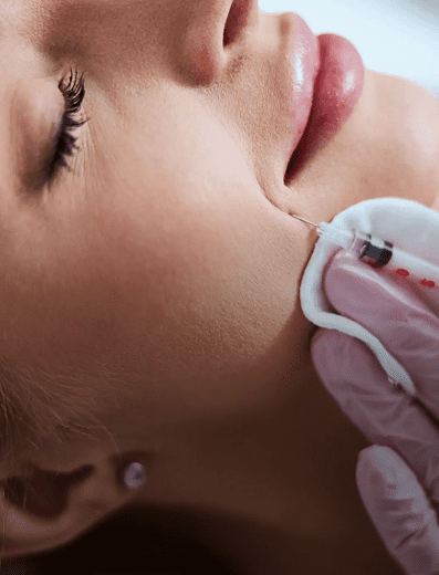 Close-up of a facial treatment with a cosmetic device on a woman's cheek.
