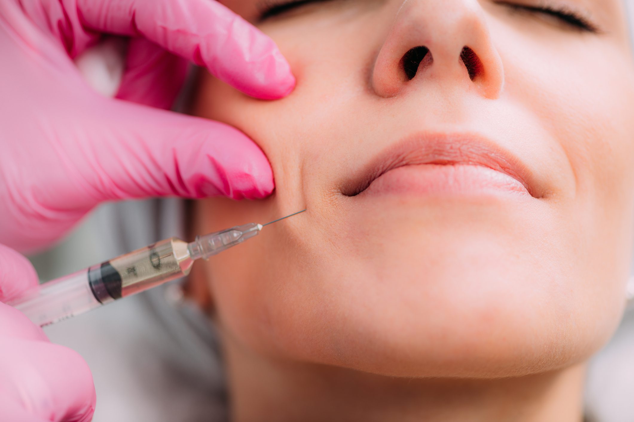 A woman receiving a cosmetic injection in her cheek.