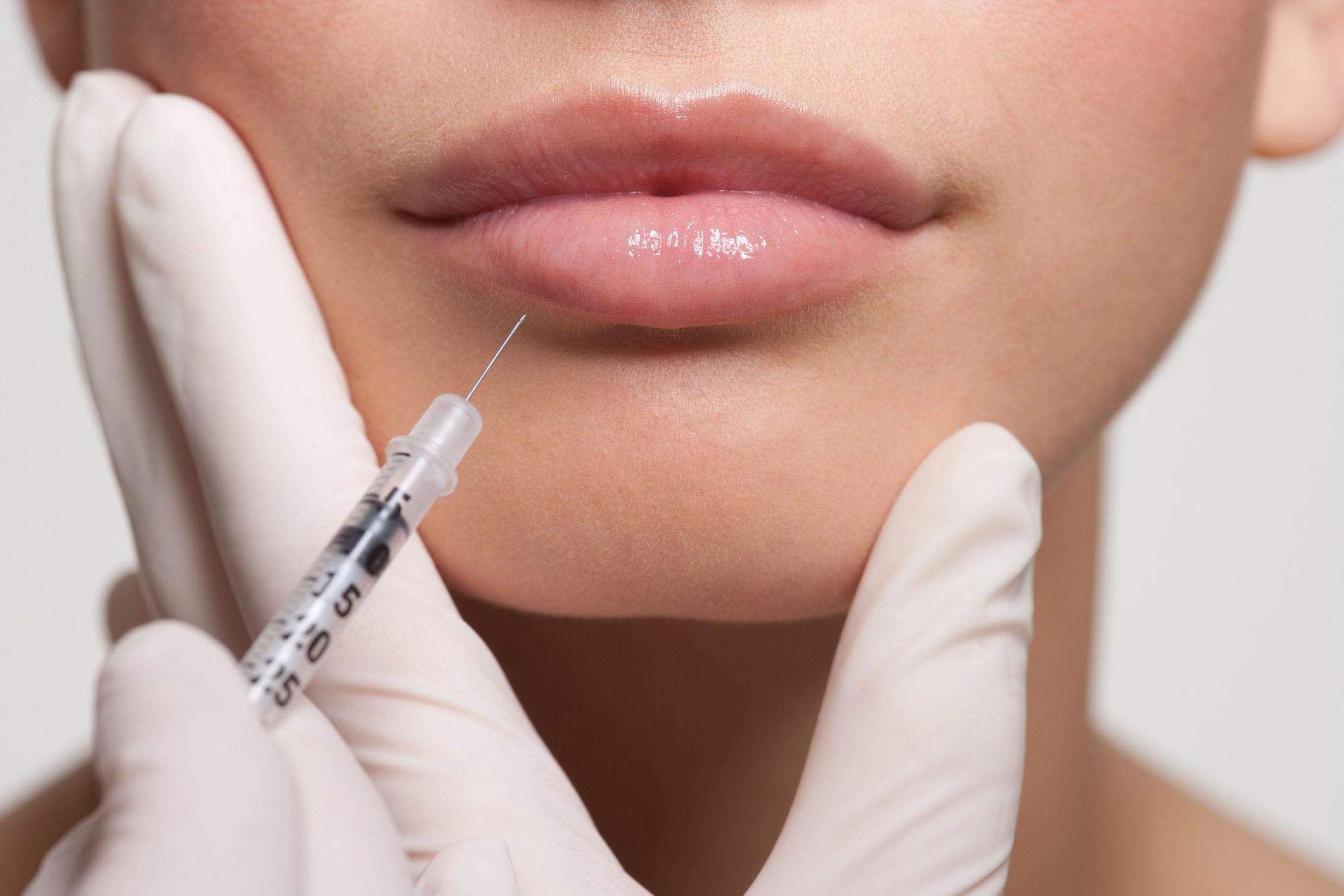 Close-up of lip injection procedure with syringe.